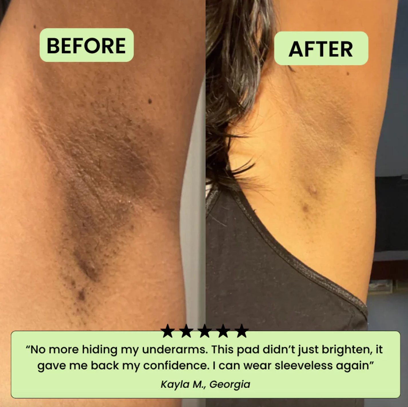 KOREAN TONER PADS - FADE DARK SPOTS AND WRINKLES FAST